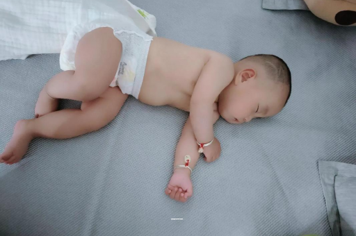 儋州宝宝上火有眼屎